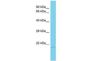 Host: Rabbit Target Name: C15orf53 Sample Type: HT1080 Whole Cell lysates Antibody Dilution: 1. (C15ORF53 anticorps  (N-Term))