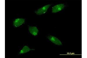 Immunofluorescence of purified MaxPab antibody to MGAT1 on HeLa cell. (MGAT1 anticorps  (AA 1-445))