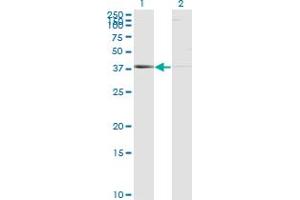 Western Blotting (WB) image for anti-Proteasome (Prosome, Macropain) Subunit, beta Type, 8 (Large Multifunctional Peptidase 7) (PSMB8) (AA 173-272) antibody (ABIN562483)