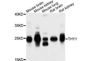 Western blot analysis of extracts of exosome from various cells, using THY1 antibody. (CD90 anticorps)