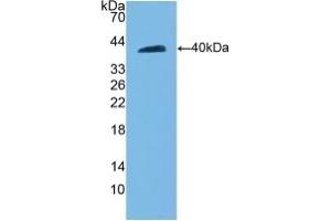 Detection of Recombinant CDH5, Rat using Polyclonal Antibody to Cadherin 5 (CDH5) (Cadherin 5 anticorps  (AA 59-382))