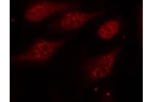 Immunofluorescence staining of methanol-fixed Hela cells, using Phospho-TP53-S315 antibody. (p53 anticorps  (pSer315))