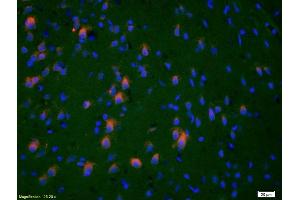 Immunofluorescence (IF) image for anti-Heat Shock 27kDa Protein 1 (HSPB1) (AA 101-205) antibody (ABIN672441)