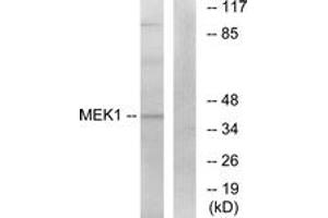 Western blot analysis of extracts from K562 cells, treated with, using MEK1 (Ab-291) Antibody. (MEK1 anticorps  (AA 261-310))