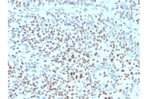 IHC analysis of formalin-fixed, paraffin-embedded human bladder. (Recombinant CDKN1B anticorps)