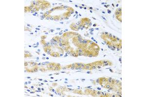 Immunohistochemistry of paraffin-embedded human stomach using ApoE antibody (ABIN5975768) at dilution of 1/100 (40x lens). (APOE anticorps)