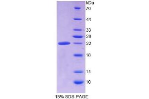 SDS-PAGE analysis of Human ALDH1A3 Protein. (ALDH1A3 Protéine)