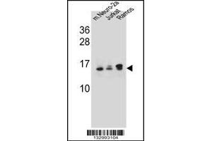 Western blot analysis in mouse Neuro-2a,Jurkat,Ramos cell line lysates (35ug/lane). (UBE2E2 anticorps  (N-Term))