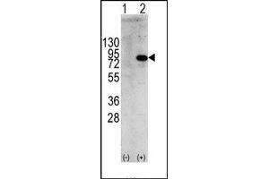 Image no. 1 for anti-Phosphoinositide 3 Kinase, p85 alpha (PI3K p85a) (Tyr580) antibody (ABIN360457) (PIK3R1 anticorps  (Tyr580))