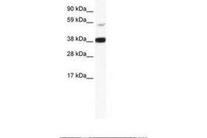 Image no. 1 for anti-V-Rel Reticuloendotheliosis Viral Oncogene Homolog B (RELB) (AA 358-407) antibody (ABIN202760) (RELB anticorps  (AA 358-407))