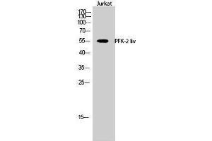 Western Blotting (WB) image for anti-PFK-2 LIV (C-Term) antibody (ABIN3180808) (PFK-2 LIV (C-Term) anticorps)
