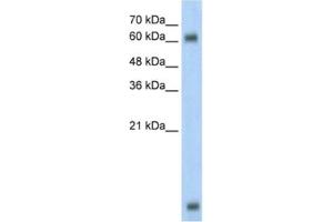 Western Blotting (WB) image for anti-Methyl-CpG Binding Domain Protein 1 (MBD1) antibody (ABIN2460355) (MBD1 anticorps)