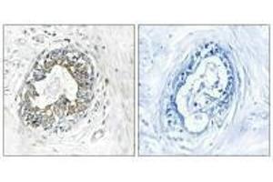 Immunohistochemistry analysis of paraffin-embedded human placenta tissue using PAK1/2 (Ab-199) antibody. (PAK1 anticorps  (Ser199))