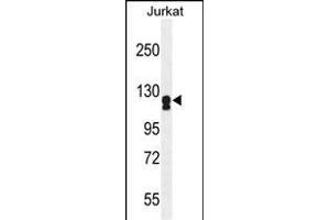 ADCY2 Antibody (Center) (ABIN655269 and ABIN2844861) western blot analysis in Jurkat cell line lysates (35 μg/lane). (ADCY2 anticorps  (AA 451-481))