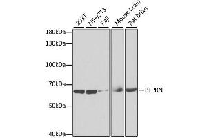 Western blot analysis of extracts of various cell lines, using PTPRN antibody. (PTPRN anticorps)