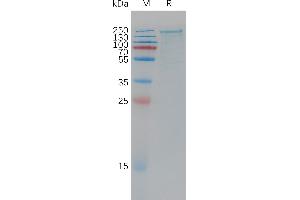 LRP6 Protein (AA 20-1370) (His tag)