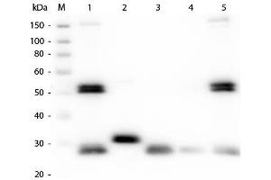 Western Blot of Anti-Rat IgG (H&L) (GOAT) Antibody (Min X Bv Ch Gt GP Ham Hs Hu Ms Rb & Sh Serum Proteins) . (Chèvre anti-Rat IgG (Heavy & Light Chain) Anticorps (Alkaline Phosphatase (AP)) - Preadsorbed)