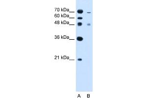 WB Suggested Anti-ZFYVE27 Antibody Titration:  2. (ZFYVE27 anticorps  (C-Term))
