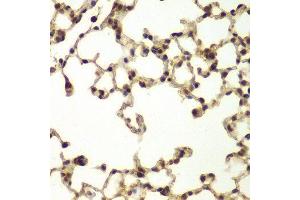 Immunohistochemistry (IHC) image for anti-DNA Repair Protein Complementing XP-B Cells (ERCC3) (AA 513-782) antibody (ABIN6218812) (ERCC3 anticorps  (AA 513-782))