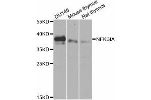 Western blot analysis of extracts of various cell lines, using NFKBIA antibody (ABIN5970533) at 1/1000 dilution. (NFKBIA anticorps)