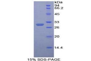 SDS-PAGE analysis of Mouse Contactin 3 Protein. (CNTN3 Protéine)