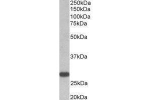 Western Blotting (WB) image for anti-Thyroid Stimulating Hormone Receptor (TSHR) (Internal Region) antibody (ABIN2464943) (TSH receptor anticorps  (Internal Region))