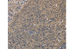 Immunohistochemistry of Human tonsil using HSF1 Polyclonal Antibody at dilution of 1:60 (HSF1 anticorps)