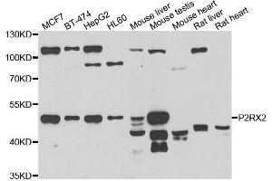 Western blot analysis of extracts of various cell lines, using P2RX2 antibody. (P2RX2 anticorps)