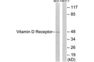 Western blot analysis of extracts from MCF-7 cells, using Vitamin D Receptor (Ab-208) Antibody. (Vitamin D Receptor anticorps  (AA 181-230))