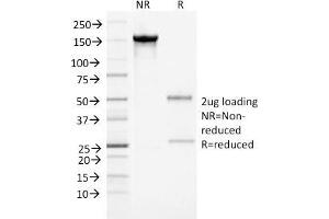 SDS-PAGE Analysis Purified Alpha-1-Antichymotrypsin Monoclonal Antibody (AACT/1452). (SERPINA3 anticorps  (AA 49-187))