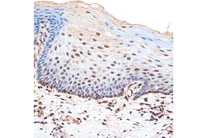 Immunohistochemistry of paraffin-embedded human esophageal using B Rabbit mAb (ABIN7265826) at dilution of 1:100 (40x lens). (BANF1 anticorps)