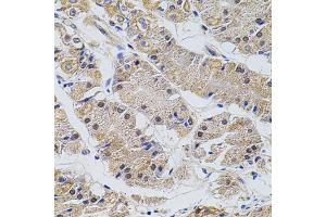 Immunohistochemistry of paraffin-embedded human stomach using TRMT2A antibody. (TRMT2A anticorps)