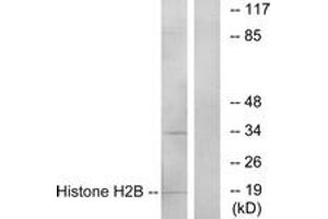 Western blot analysis of extracts from A549 cells, using Histone H2B Antibody. (Histone H2B anticorps  (AA 1-50))
