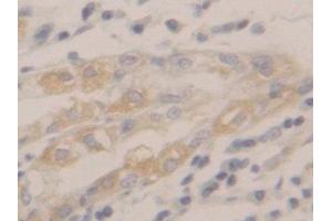 DAB staining on IHC-P; Samples: Human Stomach Tissue (Peroxiredoxin 2 anticorps  (AA 6-164))