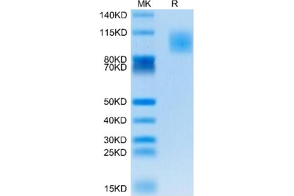 PODXL2 Protein (AA 33-500) (His tag)