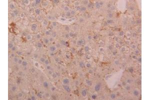 DAB staining on IHC-P; Samples: Human Liver Tissue (Cathepsin D anticorps  (AA 23-161))