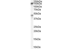 Western Blotting (WB) image for anti-Chromosome 11 Open Reading Frame 70 (C11ORF70) (C-Term) antibody (ABIN2790946) (C11ORF70 anticorps  (C-Term))