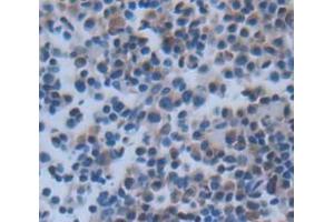 IHC-P analysis of Rat Tissue, with DAB staining. (CMA1 anticorps  (AA 22-247))