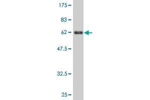 Western Blot detection against Immunogen (63. (BDH1 anticorps  (AA 1-343))