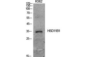 Western Blot analysis of K562 cells using 11β-HSD1 Polyclonal Antibody. (HSD11B1 anticorps  (N-Term))