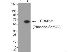 Western blot analysis of extracts from HuvEc cells (Lane 2), using CRMP-2 (Phospho-Ser522) Antibody. (DPYSL2 anticorps  (pSer522))