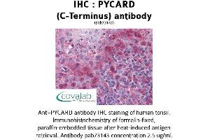 Image no. 2 for anti-PYD and CARD Domain Containing (PYCARD) (C-Term) antibody (ABIN1738638) (PYCARD anticorps  (C-Term))