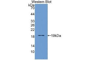 Western blot analysis of the recombinant protein. (IL3RA anticorps  (AA 19-157))