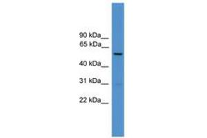 Image no. 1 for anti-Dopachrome Tautomerase (DCT) (AA 161-210) antibody (ABIN6745317) (DCT anticorps  (AA 161-210))