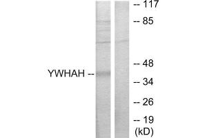 Western Blotting (WB) image for anti-14-3-3 eta (YWHAH) (Internal Region) antibody (ABIN1850145) (14-3-3 eta anticorps  (Internal Region))