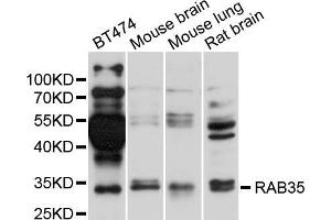 Western blot analysis of extracts of various cell lines, using RAB35 antibody (ABIN5995506) at 1/1000 dilution. (RAB35 anticorps)