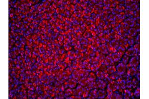 Immunofluorescence (IF) image for anti-Beclin 1, Autophagy Related (BECN1) (AA 201-330) antibody (ABIN675384)