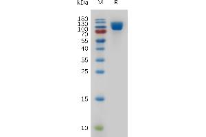 Human CD106 Protein, His Tag on SDS-PAGE under reducing condition. (VCAM1 Protein (AA 25-698) (His tag))