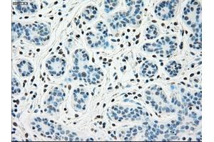 Immunohistochemical staining of paraffin-embedded breast tissue using anti-SSB mouse monoclonal antibody. (SSB anticorps)