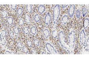 Human tonsil: immunohistochemical staining for CD56. (CD56 anticorps  (Extracellular Domain))